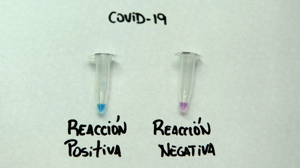 El test rápido creado por científicos argentinos muestra el resultado a través d eun cambio en la coloración del reactivo. 