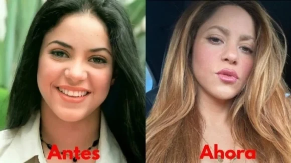 Las supuestas cirugías de Shakira. Foto archivo.
